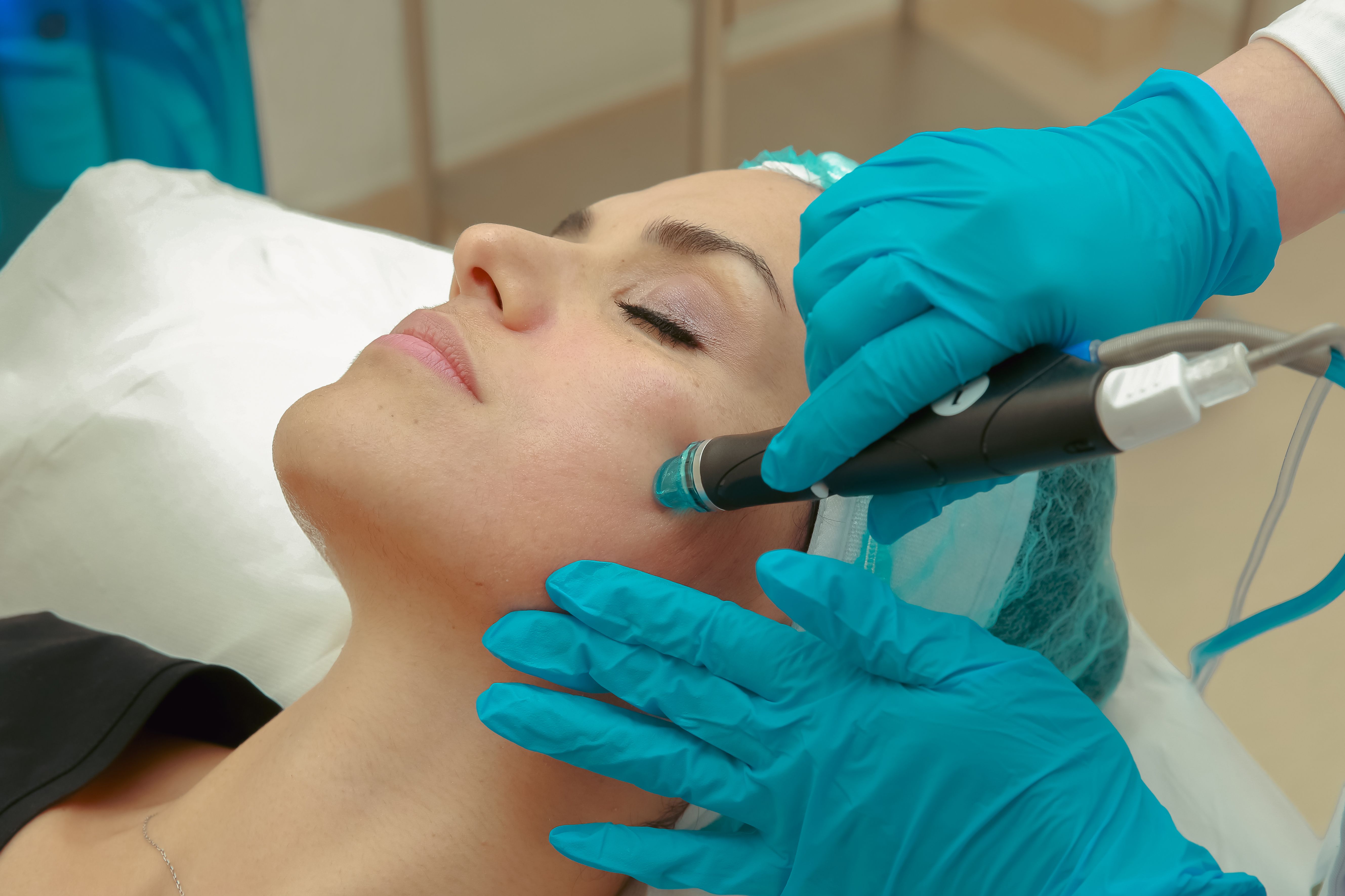 HydraFacial vortex-tip treatment