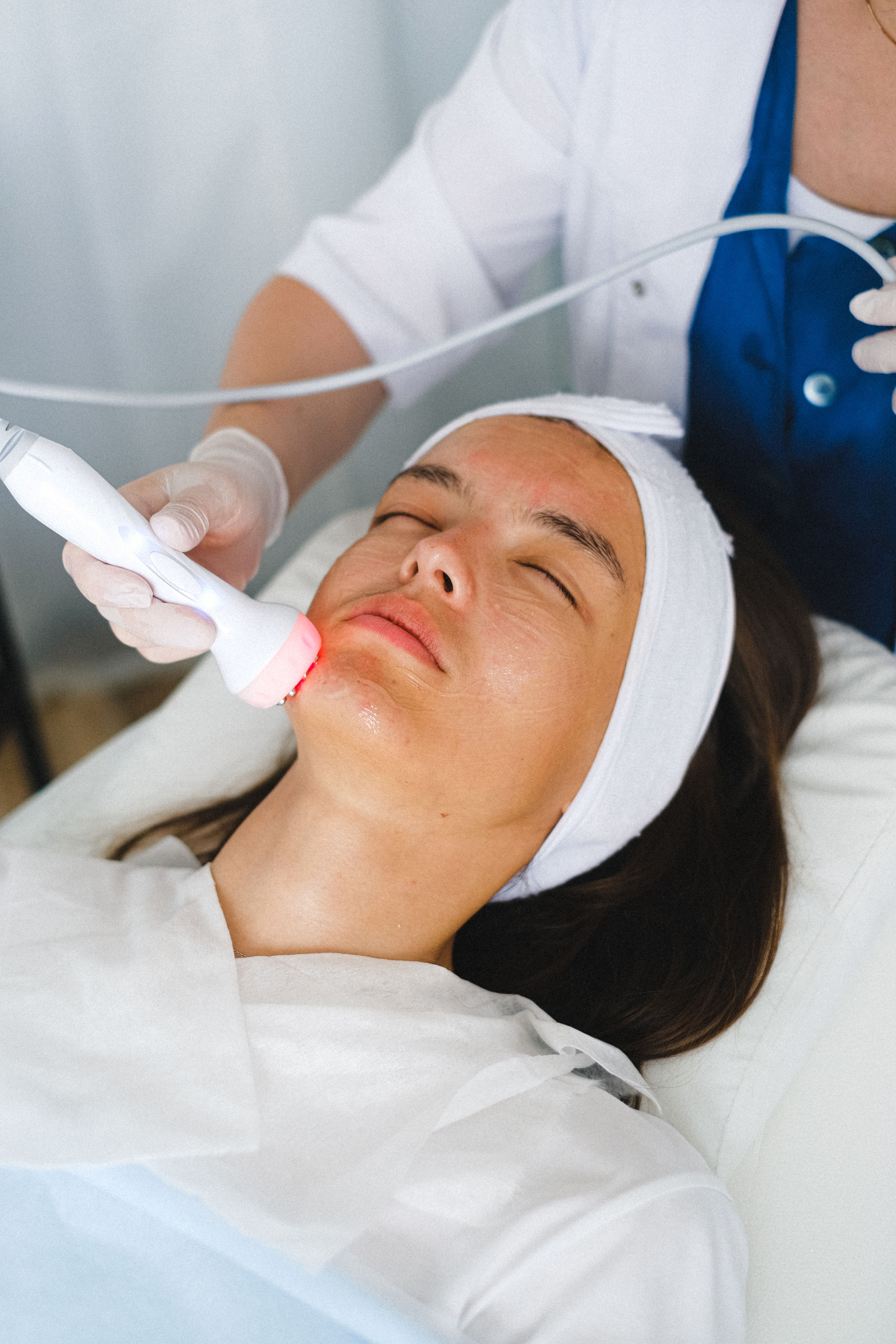 Radiofrequency skin tightening treatment